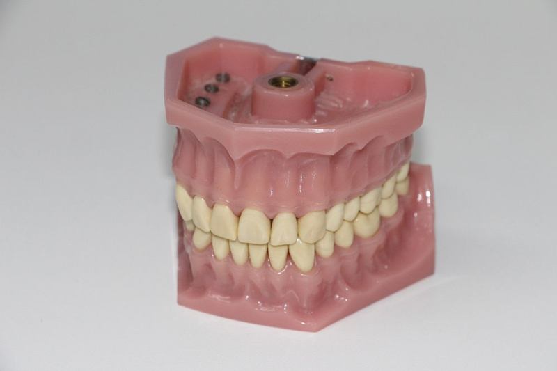 Dentadura postiza completa, superior e inferior, sobre fondo claro